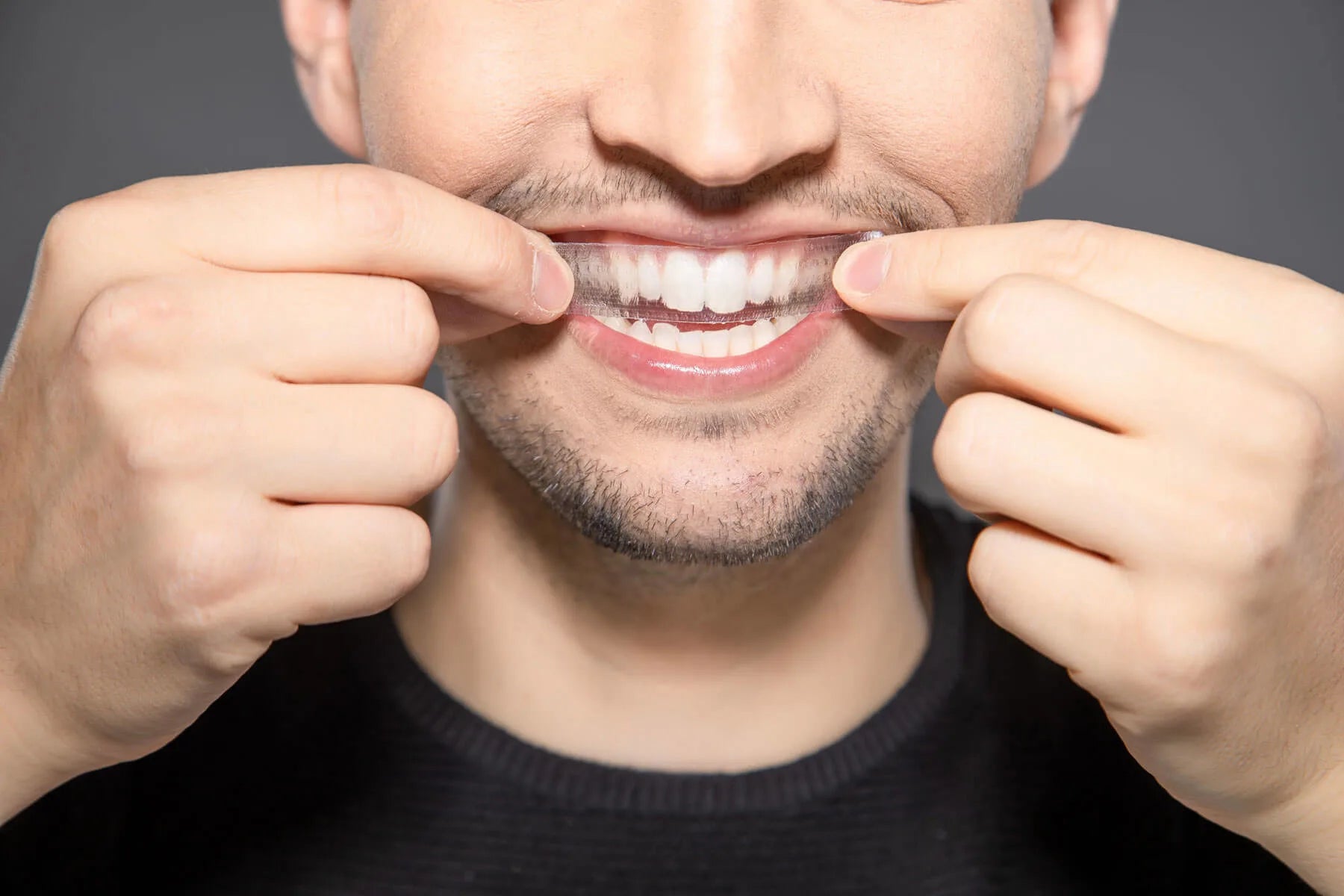 Long term effects of whitening strips on teeth and gums