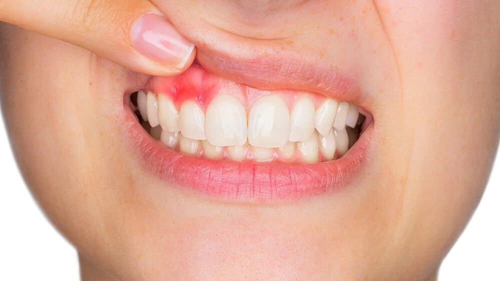 How to Improve Gum Health: Tips for a Healthier Smile