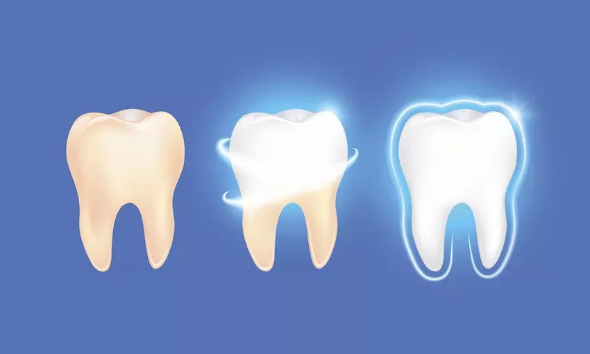 Teeth Whitening Toothpaste: Does it really work? – Perfora - Oral Care Solutions