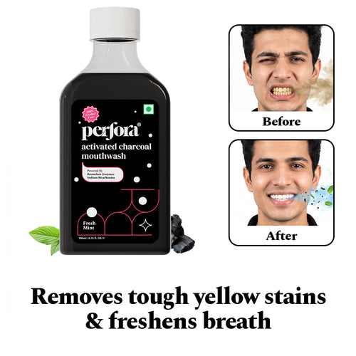 Activated Charcoal Mouthwash for Teeth Whitening