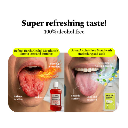 Instant Fresh Breath Mouthwash 300 ML