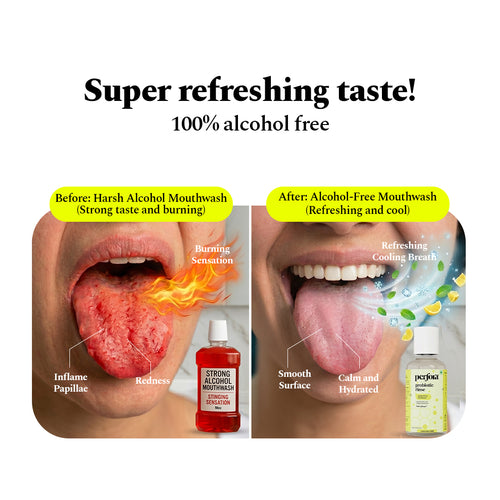 Lemon Mint Probiotic Anti-Plaque Mouthwash (500 ML)