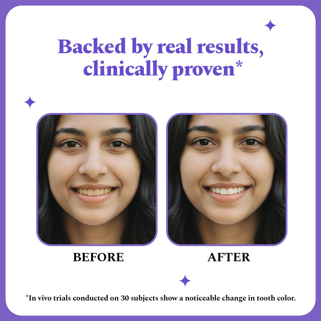 Purple Magic Teeth Whitening Strips - Self Dissolving