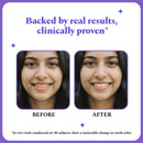 Purple Magic Teeth Whitening Strips - Self Dissolving