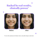 Purple Magic Teeth Whitening Strips - Self Dissolving