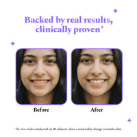 Purple Magic Teeth Whitening Strips - Self Dissolving