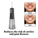 Power Dental Flosser