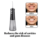 Power Dental Flosser