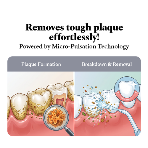 Power Dental Flosser