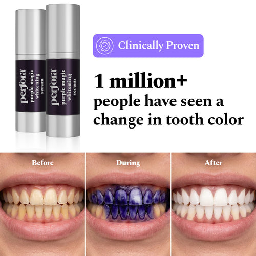 Purple Serum - Instant Teeth Whitening Solution