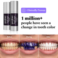 Purple Magic Teeth Whitening Serum & Whitening Strips Combo