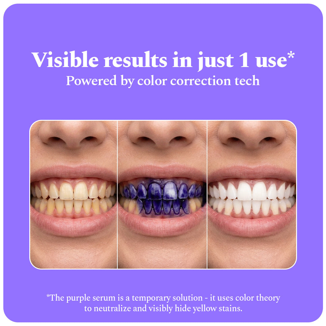 Purple Serum (30 ml) - Instant Teeth Whitening Solution