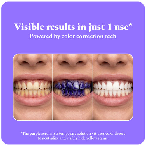 Purple Serum - Instant Teeth Whitening Solution