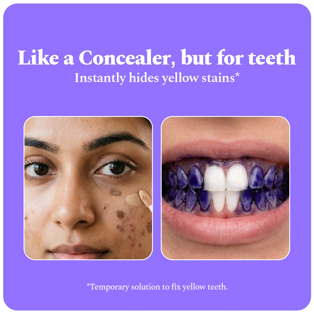 Purple Serum (30 ml) - Instant Teeth Whitening Solution