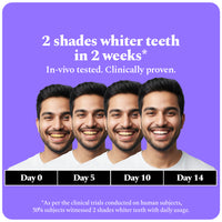 Purple Serum (30 ml) - Instant Teeth Whitening Solution