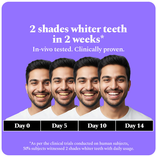 Purple Serum - Instant Teeth Whitening Solution