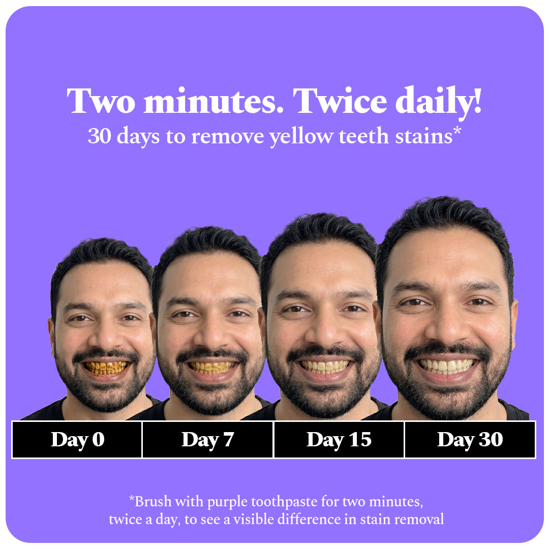 Purple Magic Whitening Toothpaste