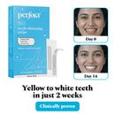Teeth Whitening Strips - Pack of 14