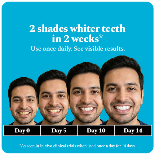 Purple Magic Teeth Whitening Serum & Whitening Strips Combo