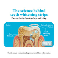 Teeth Whitening Strips - Pack of 14