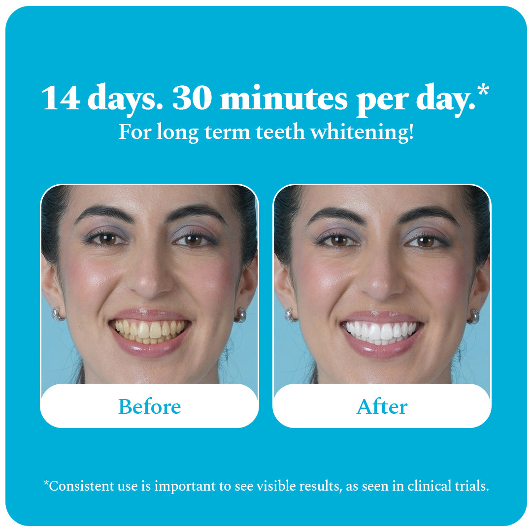 Purple Magic Teeth Whitening Serum & Whitening Strips Combo