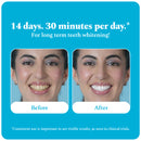 Purple Magic Teeth Whitening Serum & Whitening Strips Combo