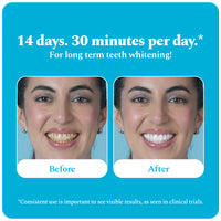 Purple Magic Teeth Whitening Serum & Whitening Strips Combo