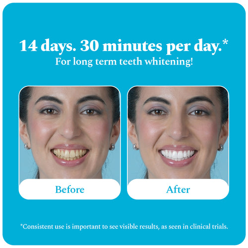 Purple Magic Teeth Whitening Serum & Whitening Strips Combo