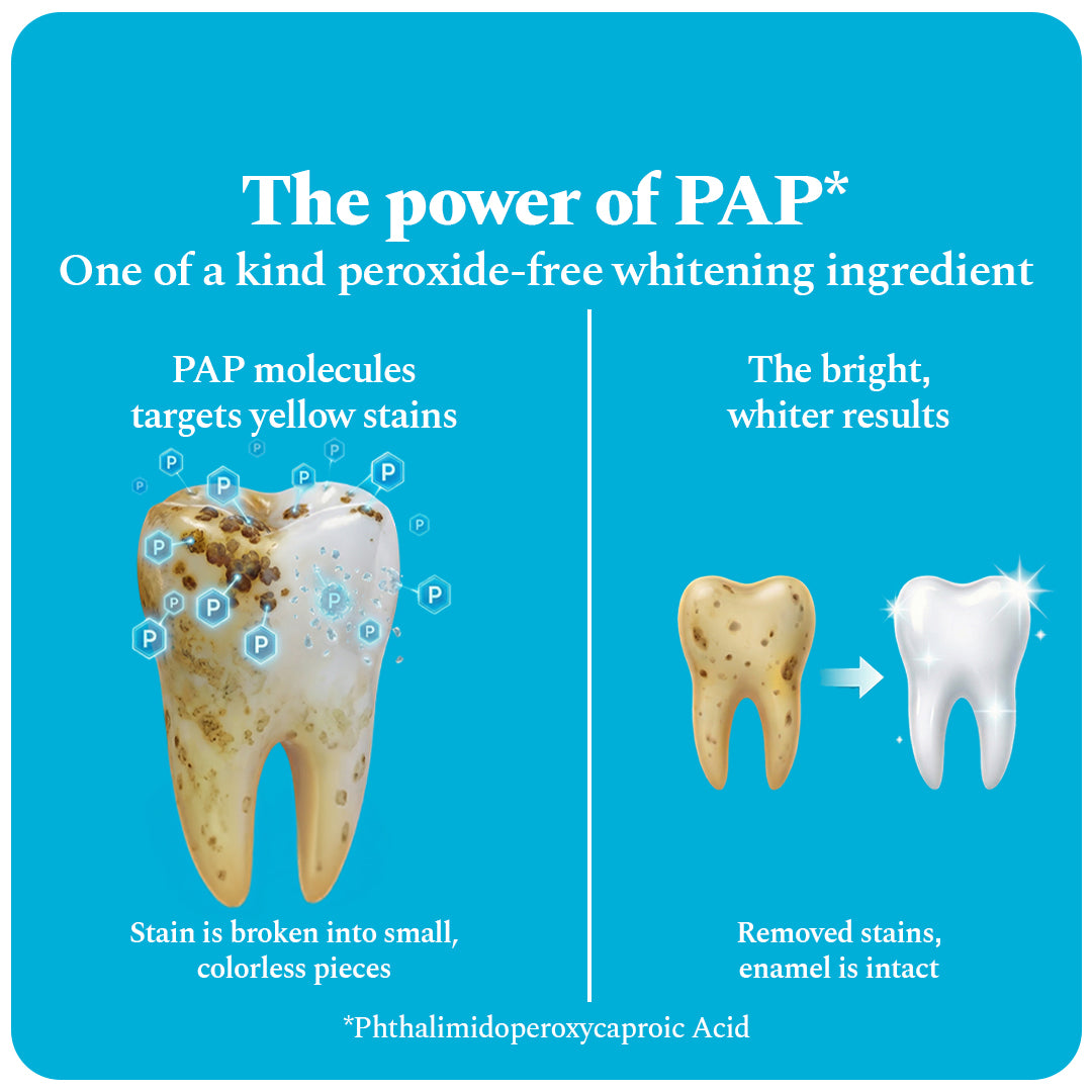 Teeth Whitening Strips - Pack of 14