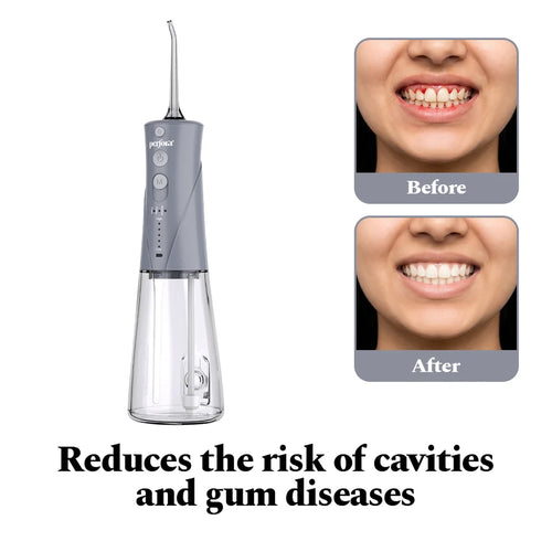 Perfora Power Dental Flosser - product view 3