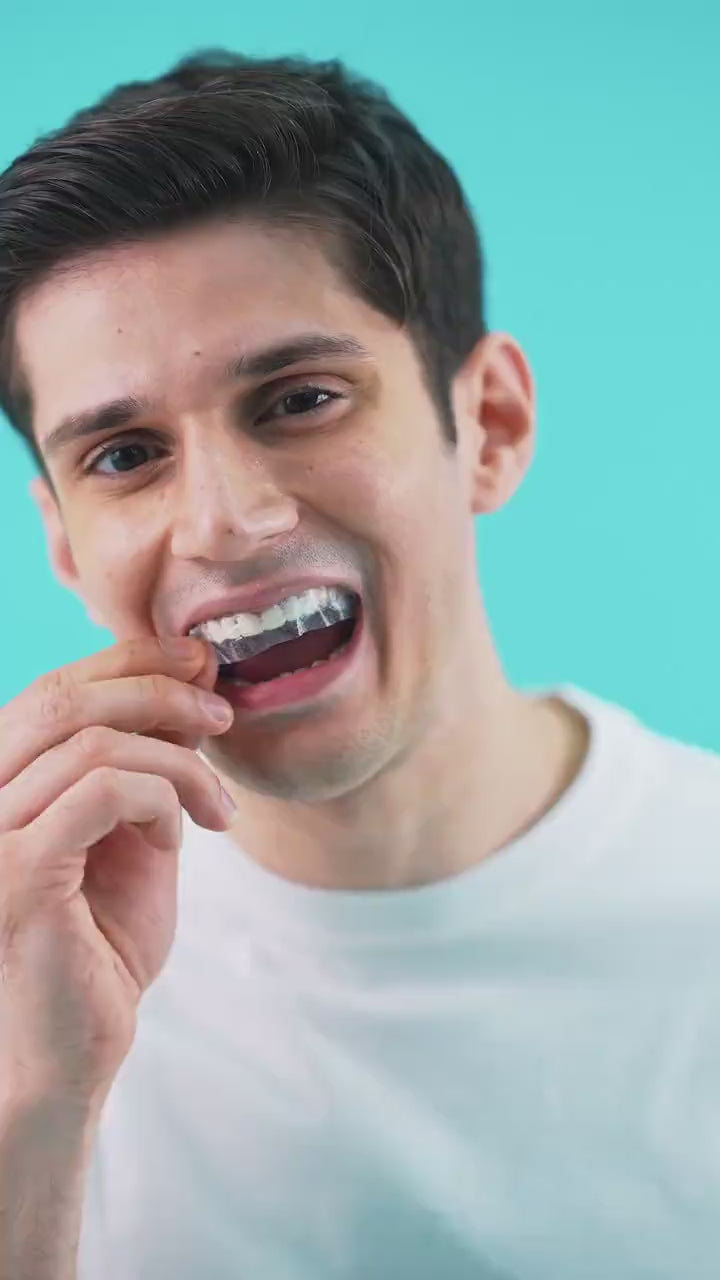 Teeth Whitening Strips - Pack of 14